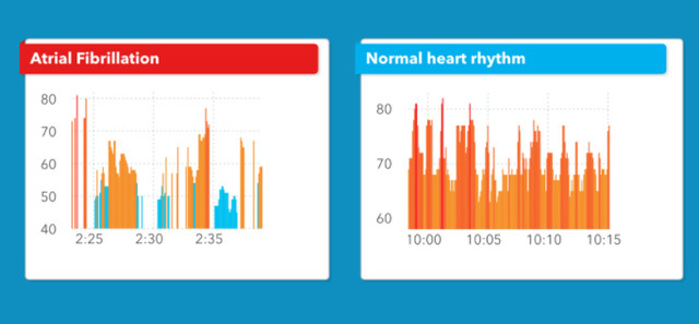 2026年智能手表对比测评：小米REDM